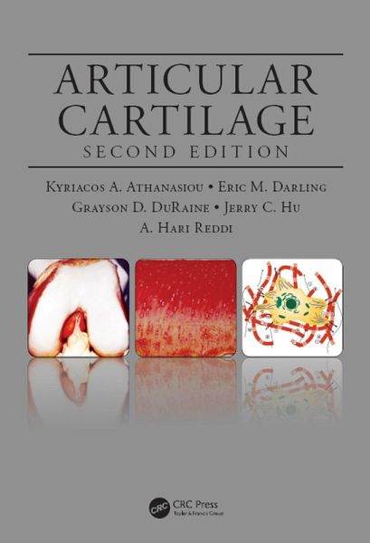 Articular Cartilage (eBook, ePUB) Articular Cartilage (eBook, ePUB)