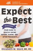 Expect the Best (eBook, ePUB)