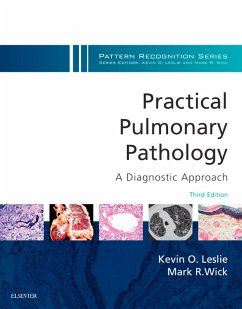 Practical Pulmonary Pathology: A Diagnostic Approach E-Book (eBook, ePUB) - Leslie, Kevin O.; Wick, Mark R.; Smith, Maxwell L.