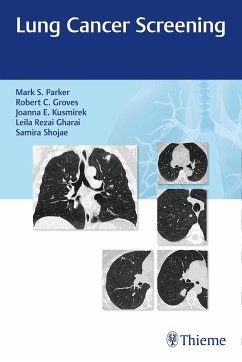 Lung Cancer Screening (eBook, PDF) - Parker, Mark; Groves, Robert; Kusmirek, Joanna; Rezai Gharai, Leila; Shojaee, Samira