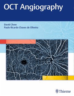 OCT Angiography (eBook, PDF) - Chow, David