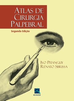 Atlas de cirurgia palpebral (eBook, ePUB) - Sbrissa, Renato Acosta; Pitanguy, Ivo