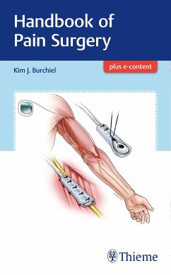 Handbook of Pain Surgery (eBook, PDF) - Burchiel, Kim