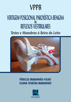 Cover Vertigem posicional paroxística benigna & reflexos vestibulares (eBook, ePUB)