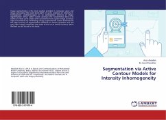 Segmentation via Active Contour Models for Intensity Inhomogeneity