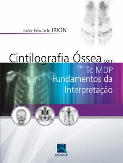 Cover Cintilografia óssea com 99mTc MDP (eBook, ePUB)