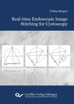 Real-time Endoscopic Image Stitching for Cystoscopy - Bergen, Tobias