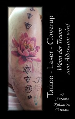 Tattoo - Laser - Cover Up - Tessnow, Antonia Katharina
