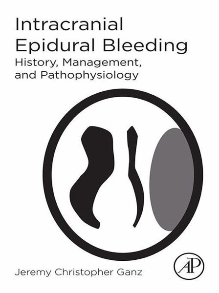 Intracranial Epidural Bleeding (eBook, ePUB)