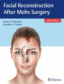 Facial Reconstruction After Mohs Surgery (eBook, PDF)