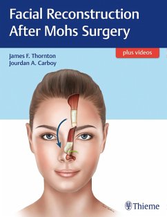Cover Facial Reconstruction After Mohs Surgery (eBook, PDF)