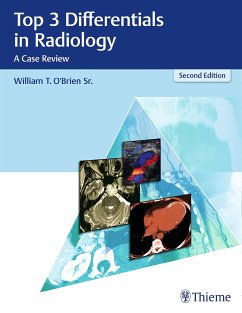 Top 3 Differentials in Radiology (eBook, PDF) - O'Brien, William T.