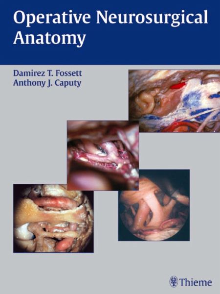 Operative Neurosurgical Anatomy (eBook, PDF)