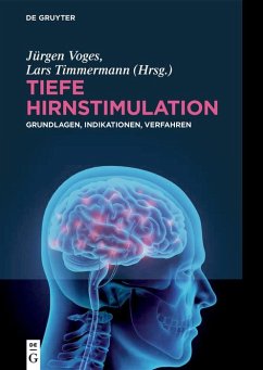 Tiefe Hirnstimulation (eBook, PDF)