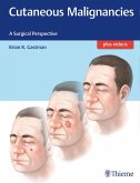 Cutaneous Malignancies (eBook, PDF)