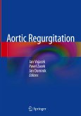 Aortic Regurgitation