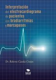 Interpretación del electrocardiograma de pacientes con bradiarritmias y marcapasos