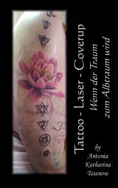Tattoo - Laser - Cover Up (eBook, ePUB)