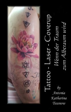 Tattoo - Laser - Cover Up (eBook, ePUB) - Tessnow, Antonia Katharina
