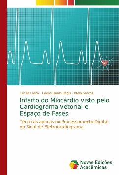 Infarto do Miocárdio visto pelo Cardiograma Vetorial e Espaço de Fases