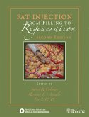 Fat Injection (eBook, ePUB)