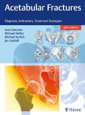 Acetabular Fractures (eBook, PDF)