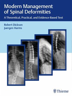 Modern Management of Spinal Deformities (eBook, PDF) Cover Modern Management of Spinal Deformities (eBook, PDF)