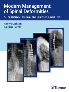 Modern Management of Spinal Deformities (eBook, PDF) - Dickson, Robert A.; Harms, Jürgen