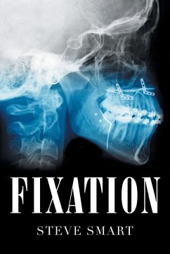 Fixation - Smart, Steve