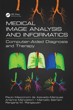 Medical Image Analysis and Informatics (eBook, PDF)