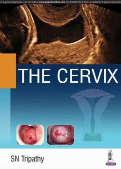 Cover The Cervix