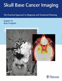 Skull Base Cancer Imaging (eBook, PDF) - Yu, Eugene; Forghani, Reza