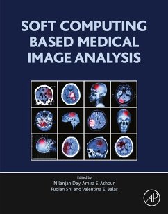Cover Soft Computing Based Medical Image Analysis (eBook, ePUB)