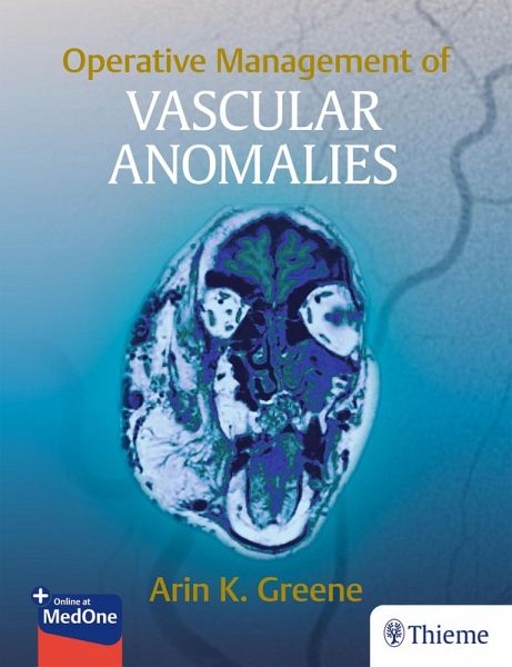 Operative Management of Vascular Anomalies (eBook, PDF) Operative Management of Vascular Anomalies (eBook, PDF)