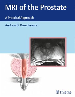 MRI of the Prostate (eBook, PDF)