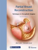 Partial Breast Reconstruction (eBook, PDF)