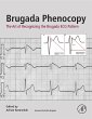 Brugada Phenocopy (eBook, ePUB) - Bild 1