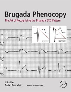 Cover Brugada Phenocopy (eBook, ePUB)