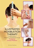 Illustrated Moxibustion Therapy: A Natural Way of Prevention and Treatment Through Traditional Chinese Medicine