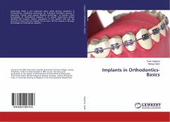 Implants in Orthodontics- Basics - Kalgotra, Sneh;Qadir, Mariya