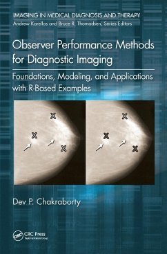 Observer Performance Methods for Diagnostic Imaging (eBook, ePUB) - Chakraborty, Dev P.