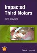 Impacted Third Molars (eBook, PDF) - Bild 1