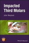 Impacted Third Molars (eBook, PDF) Impacted Third Molars (eBook, PDF)