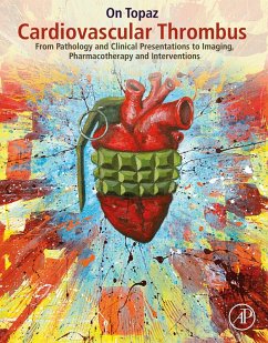 Cover Cardiovascular Thrombus (eBook, ePUB)
