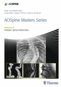 AOSpine Masters Series, Volume 9: Pediatric Spinal Deformities (eBook, PDF)