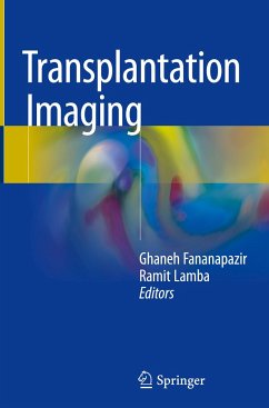 Transplantation Imaging