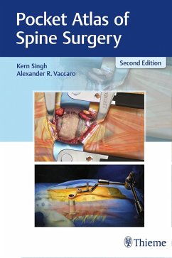 Pocket Atlas of Spine Surgery (eBook, PDF) - Singh, Kern; Vaccaro, Alexander