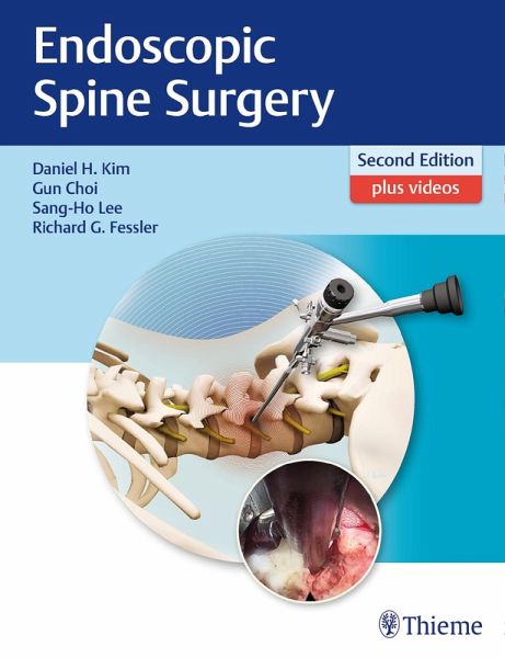 Endoscopic Spine Surgery (eBook, PDF)