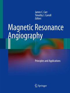 Magnetic Resonance Angiography