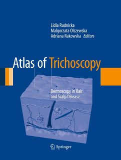 Atlas of Trichoscopy